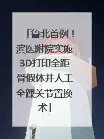 鲁北首例！滨医附院实施3D打印全距骨假体并人工全踝关节置换术